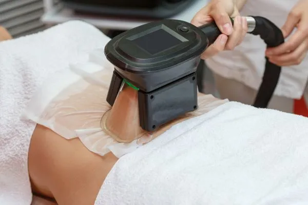 Image of person having fat freezing treatment to help weight gain Netherton