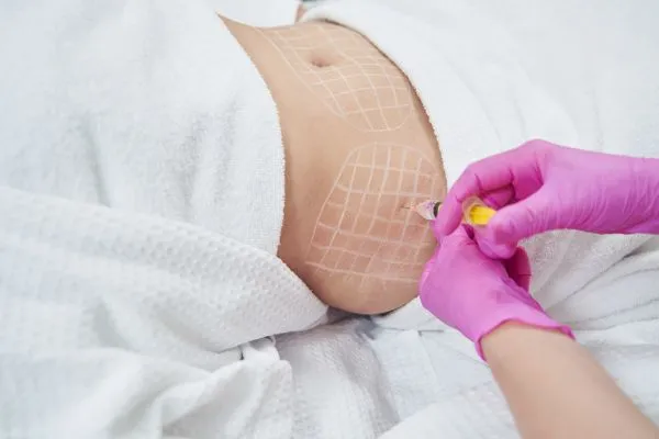 image of fat dissolving injections on love handles to help combat weight gain Netherton